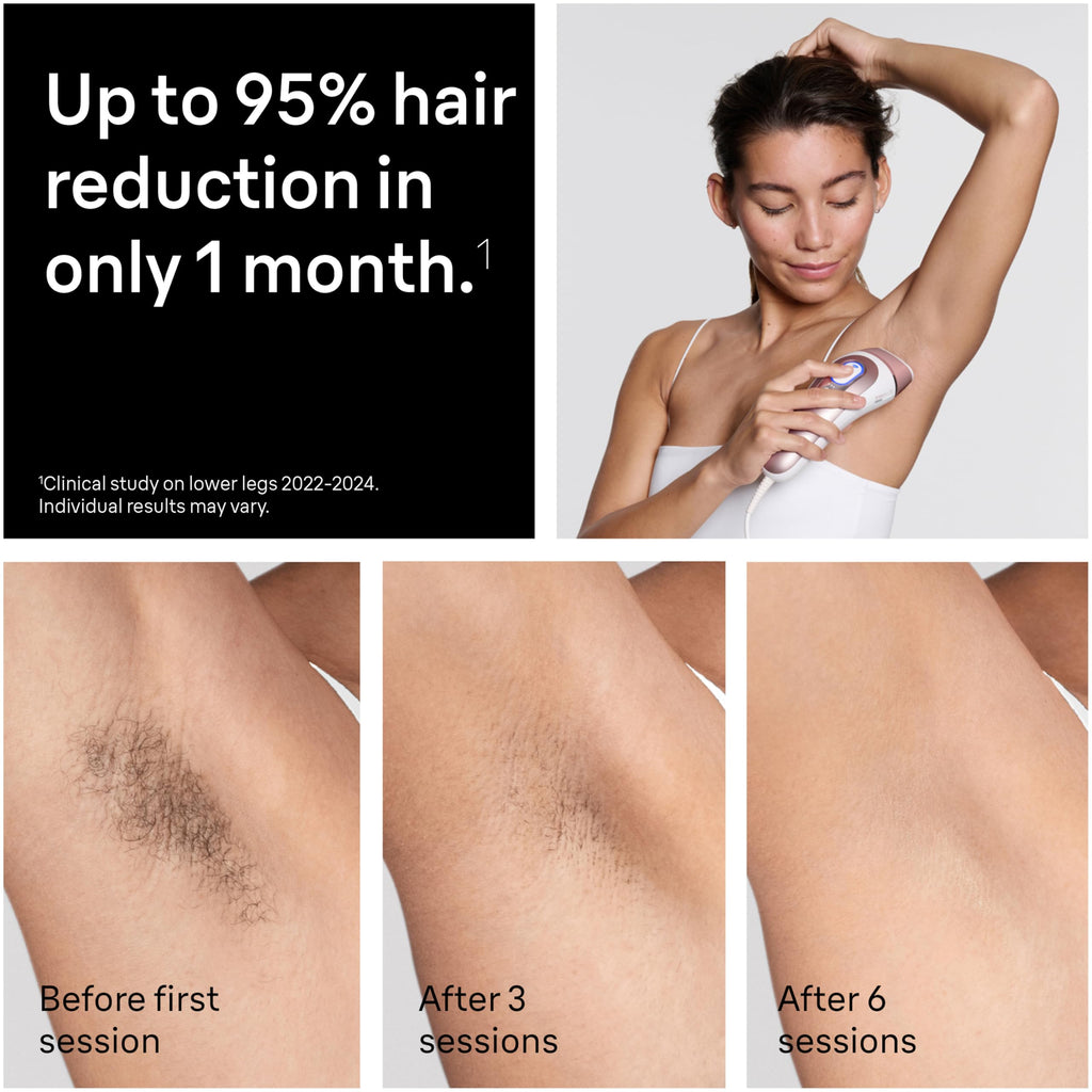 Braun Smart IPL Hair Removal Device – Skin i·Expert Pro 7, 4 Heads, Permanent Reduction for Women & Men